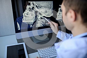 lateral view of a male radiologist examining a x-ray