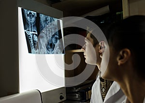 Lateral view: picture of two doctors exploring spinal x-ray