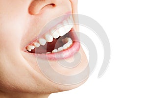 Laugh of happy woman with healthy teeth