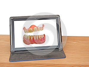 Laughing false teeth dentures on tablet computer screen