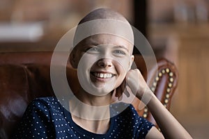 Laughing hairless woman sitting on sofa feeling happy of recovery