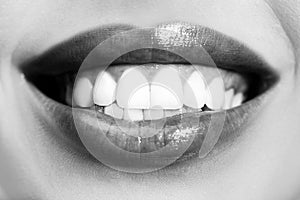 Laughing woman mouth with great teeth. Perfect smile after bleaching. Dental care and whitening teeth. Healthy smile