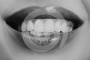 Laughing woman mouth with great teeth. Perfect smile after bleaching. Dental care and whitening teeth. Healthy smile