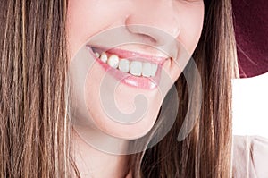 Laughing woman mouth with perfect teeth and bright smile