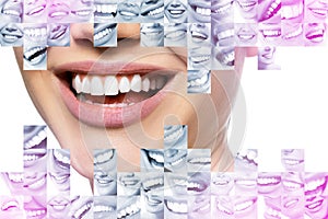 Laughing women and men with great teeth over white background. Healthy beautiful male and female smile. Teeth health, whitening,