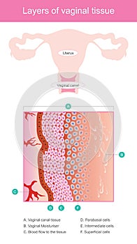 Layers of vaginal tissue. photo