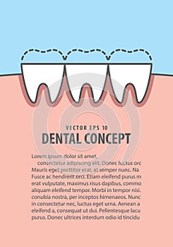Layout attrition Bruxism teeth illustration vector on blue bac