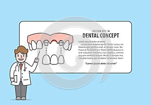 Layout Bridges teeth upper with text box and doctor cartoon style for info or book illustration vector on blue background. Dental