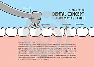 Layout decay tooth treatment Caries cartoon style for info or