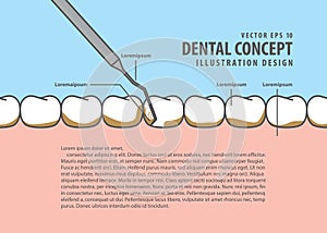 Layout Scaling teeth illustration vector on blue background. Den