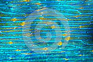 Leaf of a broom moss, with golden junctions in polarization