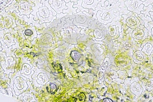 Leaf Epidermis Stomata under microscope.