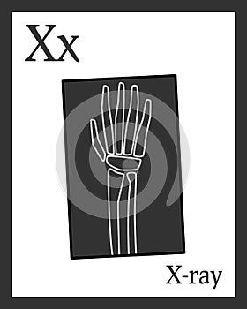 Learning the Alphabet Card - X-ray