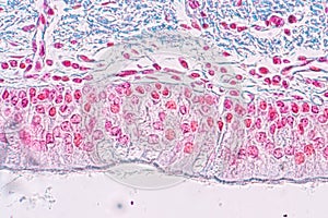 Learning anatomy and physiology of Pseudostratified columnar epithellum under the microscopic.