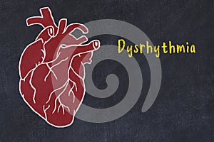 Chalk sketch of human heart on black desc and inscription Dysrhythmia photo