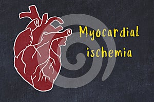 Learning cardio system concept. Chalk drawing of human heart and inscription Myocardial ischemia