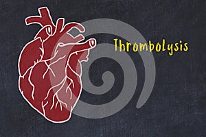 Learning cardio system concept. Chalk drawing of human heart and inscription Thrombolysis