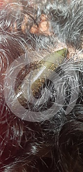 A leech therapy session