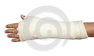 Left arm in white bandage and cast