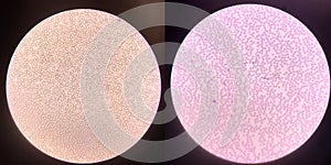 Left blood smear non stain,Right blood smear with wright gimsa stain