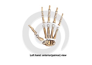 Left Hand anterior palmer Scattered view photo