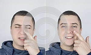 Before and after. On the left, the man indicates nose pain, and on the right, indicates that nose no longer hurts. Professional