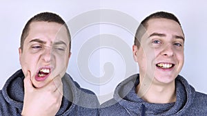 Before and after. On the left, the man indicates teeth pain, and on the right, indicates that the teeth no longer hurts. Toothache