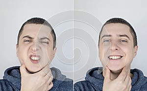 Before and after. On the left, the man indicates teeth pain, and on the right, indicates that the teeth no longer hurts. Toothache