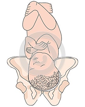 Left Occiput Posterior LOP Baby Fetal Position Pelvis  ROP Right