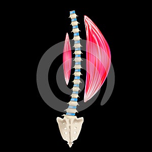 Left-sided scoliosis. Levoscoliosis. Muscles and spine. Spinal curvature in scoliosis. Infographics. Vector illustration