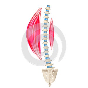 Left-sided scoliosis. Levoscoliosis. Muscles and spine. Spinal curvature in scoliosis. Infographics. Vector illustration