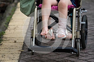 Leg broken child on wheelchair walked in park