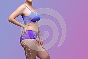Leg, buttocks, abdomen liposuction, fat and cellulite removal concept, overweight female body with painted surgical lines and