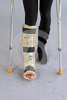 Leg cast and crutches