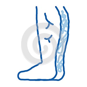 leg with varicose veins doodle icon hand drawn illustration