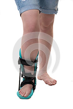 Leg of woman in feet night orthosis