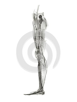 Leg X-ray