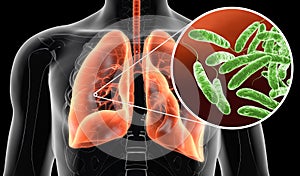 Legionella pneumophila bacteria in lungs, medically 3D illustration