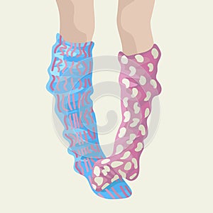 Legs in different golfs. Destky direct mistake. Different pattern. Vector illustration photo