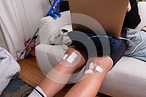 Legs of injured young woman working on laptop on the couch