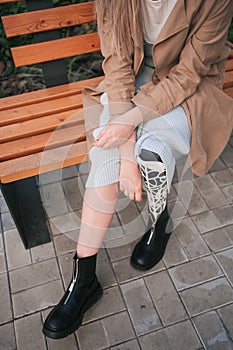 Legs of a young girl with a bionic prosthesis.