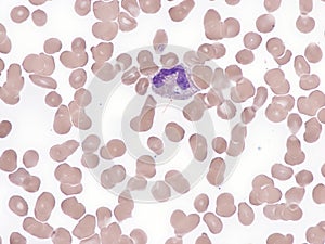 leishmania in peripheral blood.