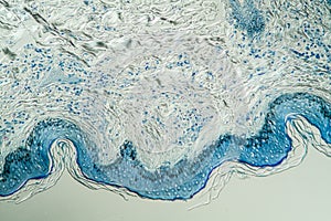 Leprosy skin under the microscope