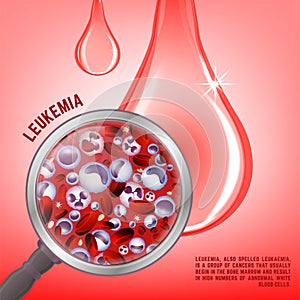 Leukemia vertical background photo