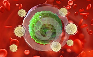 Leukocytes attack the virus. Immunity of the body. Fight against pneumonia