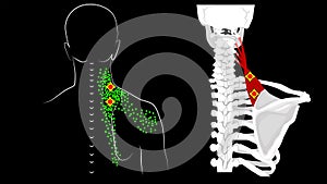 Levator scapulae muscle. Trigger points and muscle structure. Pain in the neck and shoulder blade.