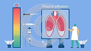 Level of treatments. Pleural effusion is collection of excess fluid between layers of pleura outside lungs. Pulmonology vector