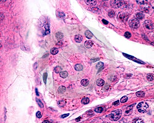 Leydig cells. Human testicle
