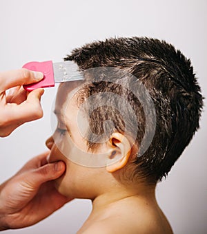 Lice treatment