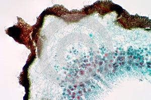 Lichen, Fungus, cross section slide under the light microscope view